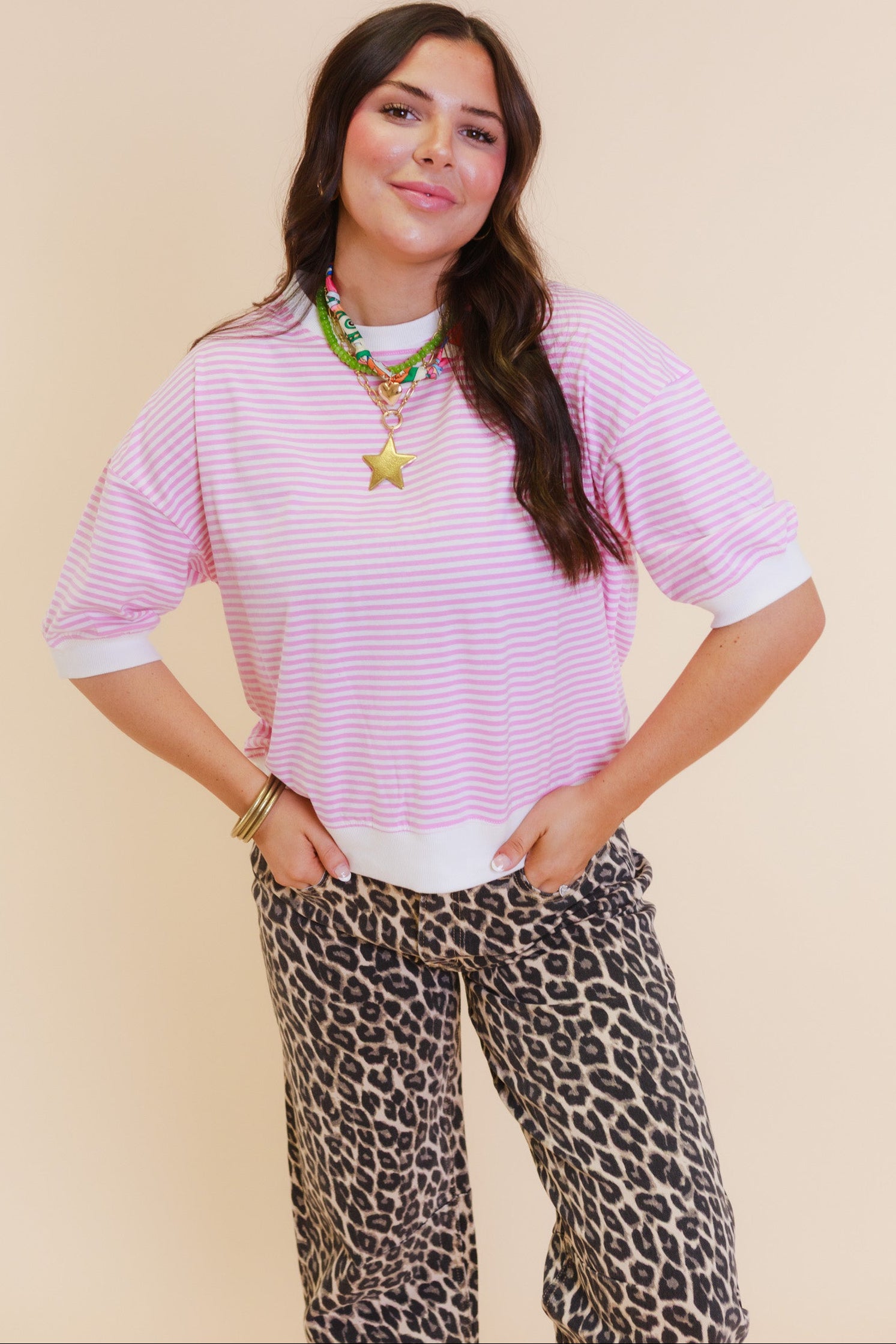 The Color Pop Stripe Top