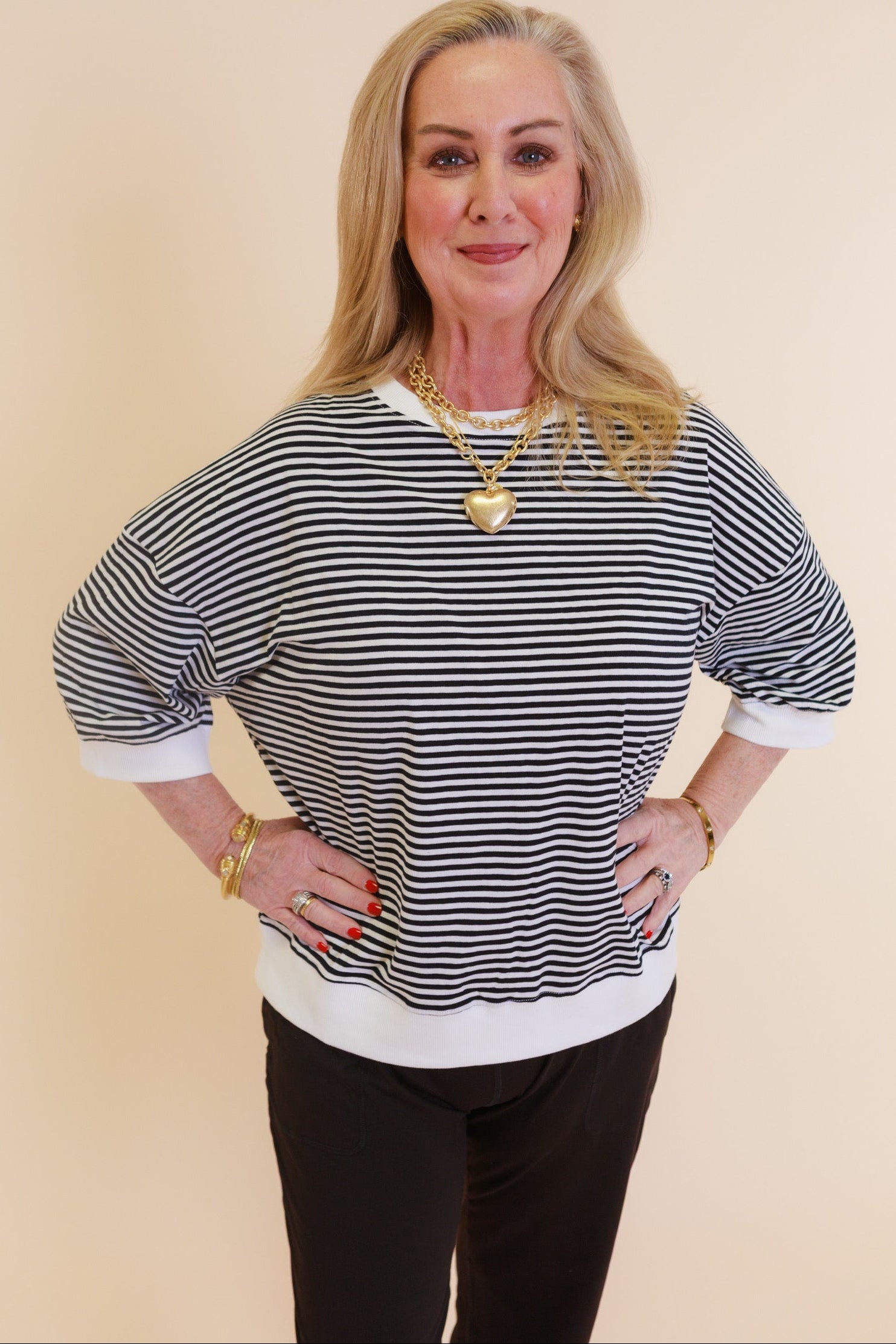 The Color Pop Stripe Top
